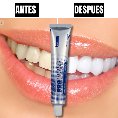 PROWHITE
